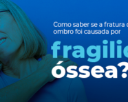 Dia Mundial da Osteoporose: Como saber se a fratura do ombro foi causada por fragilidade óssea?